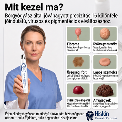 Hivatalos Márkabolt | 🚢 Hiskin® 7 napos Szemölcseltávolító Roll-on Ápoló Folyadék (Fájdalommentes rollerball technológia, hegek nélkül) 🐬