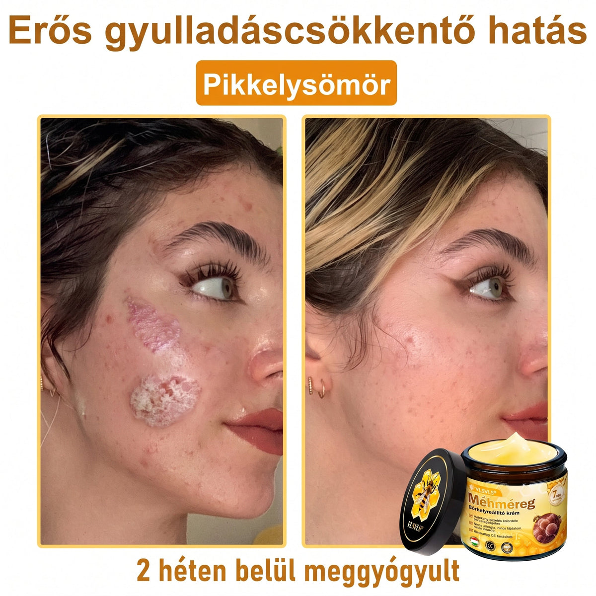 ⏰ Gratulálunk! Exkluzív 𝑽𝙇𝙎𝑽𝑳𝑺® ajánlat indult! További 50% kedvezmény – csak ma! Rendelj most a linken keresztül! ⏰