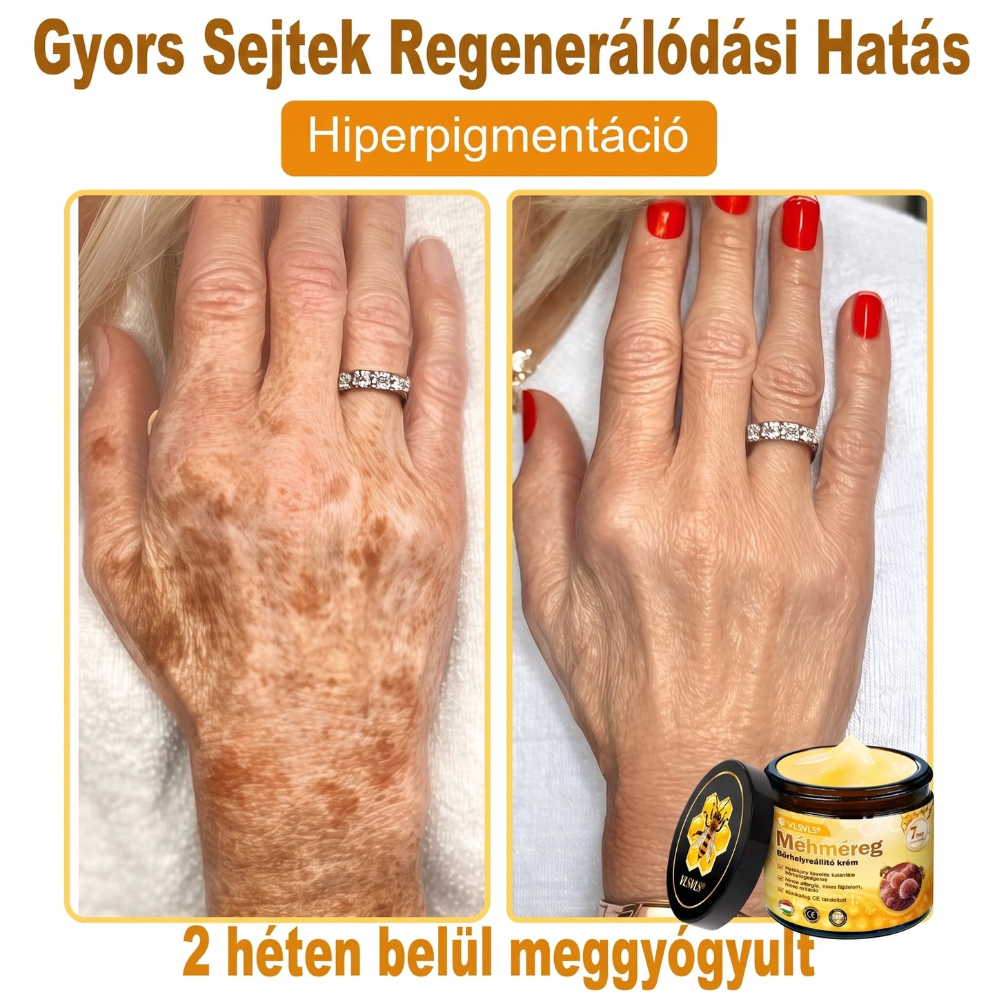 ⏰ Gratulálunk! Exkluzív 𝑽𝙇𝙎𝑽𝑳𝑺® ajánlat indult! További 50% kedvezmény – csak ma! Rendelj most a linken keresztül! ⏰