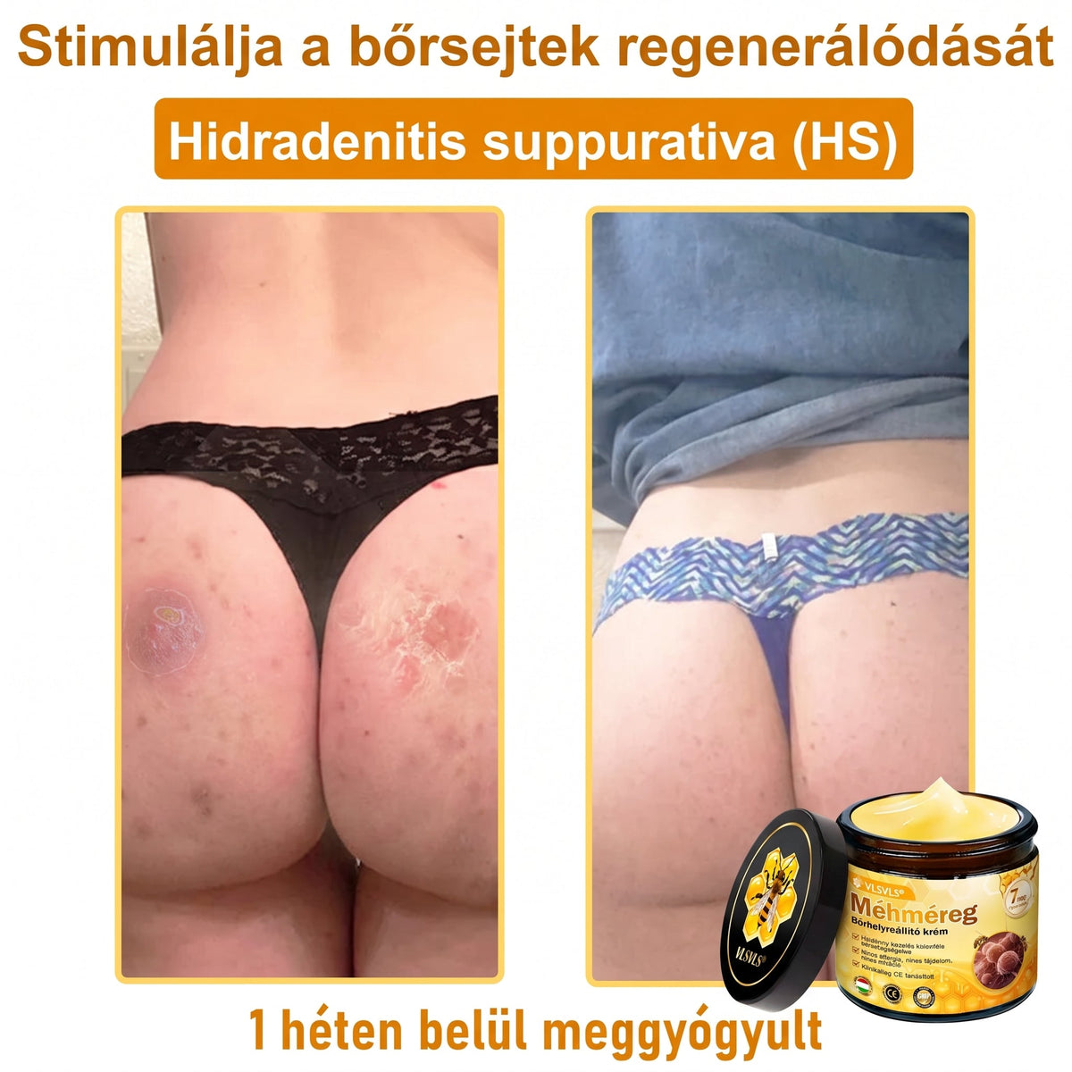 ⏰ Gratulálunk! Exkluzív 𝑽𝙇𝙎𝑽𝑳𝑺® ajánlat indult! További 50% kedvezmény – csak ma! Rendelj most a linken keresztül! ⏰