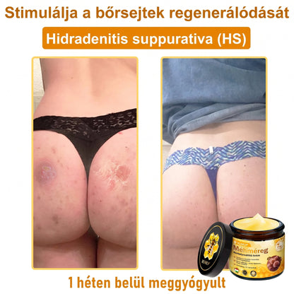 ⏰ Gratulálunk! Exkluzív 𝑽𝙇𝙎𝑽𝑳𝑺® ajánlat indult! További 50% kedvezmény – csak ma! Rendelj most a linken keresztül! ⏰