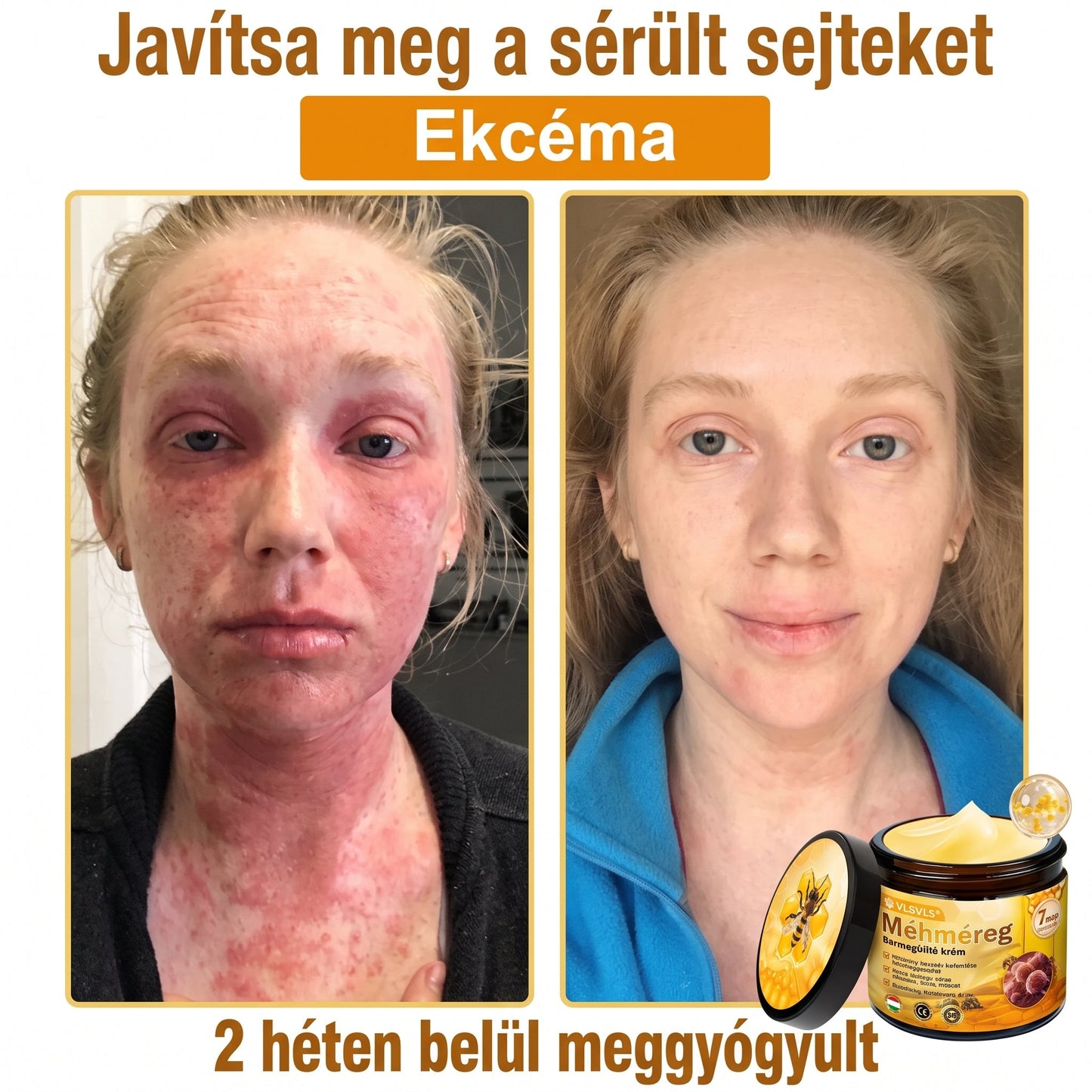 ⏰ Gratulálunk! Exkluzív 𝑽𝙇𝙎𝑽𝑳𝑺® ajánlat indult! További 50% kedvezmény – csak ma! Rendelj most a linken keresztül! ⏰